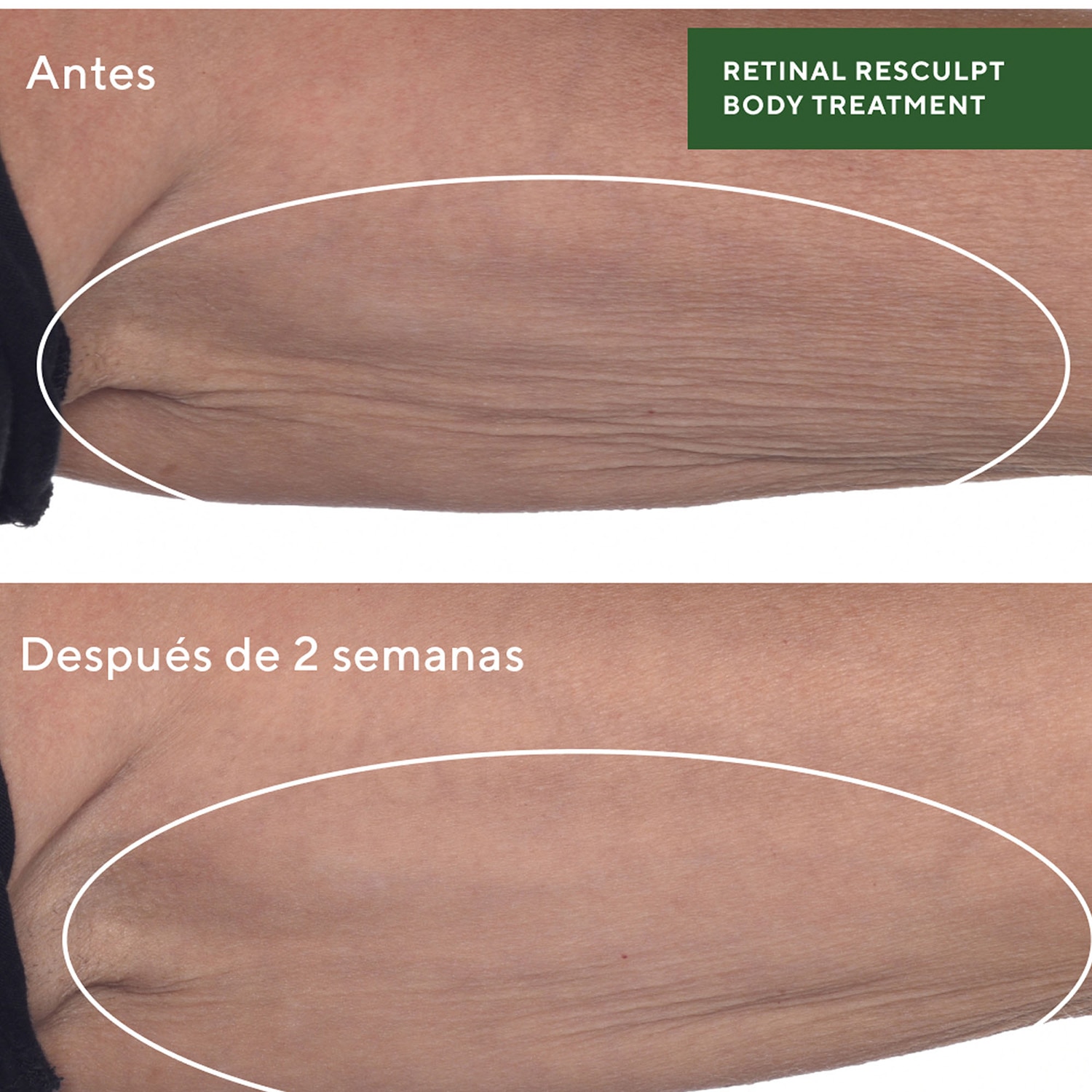 RETINAL RESCULPT BODY TREATMENT (TRATAMIENTO DE RETINAL PARA CUERPO)